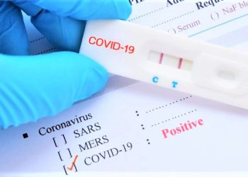 Bộ kit test nhanh Covid-19